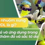 Laser nhuộm xung PDL là gì? Hiệu quả và ứng dụng trong điều trị thâm đỏ và sắc tố da