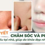 7 bí quyết chăm sóc và phục hồi da mỏng yếu tại nhà, giúp da khỏe đẹp nhanh chóng