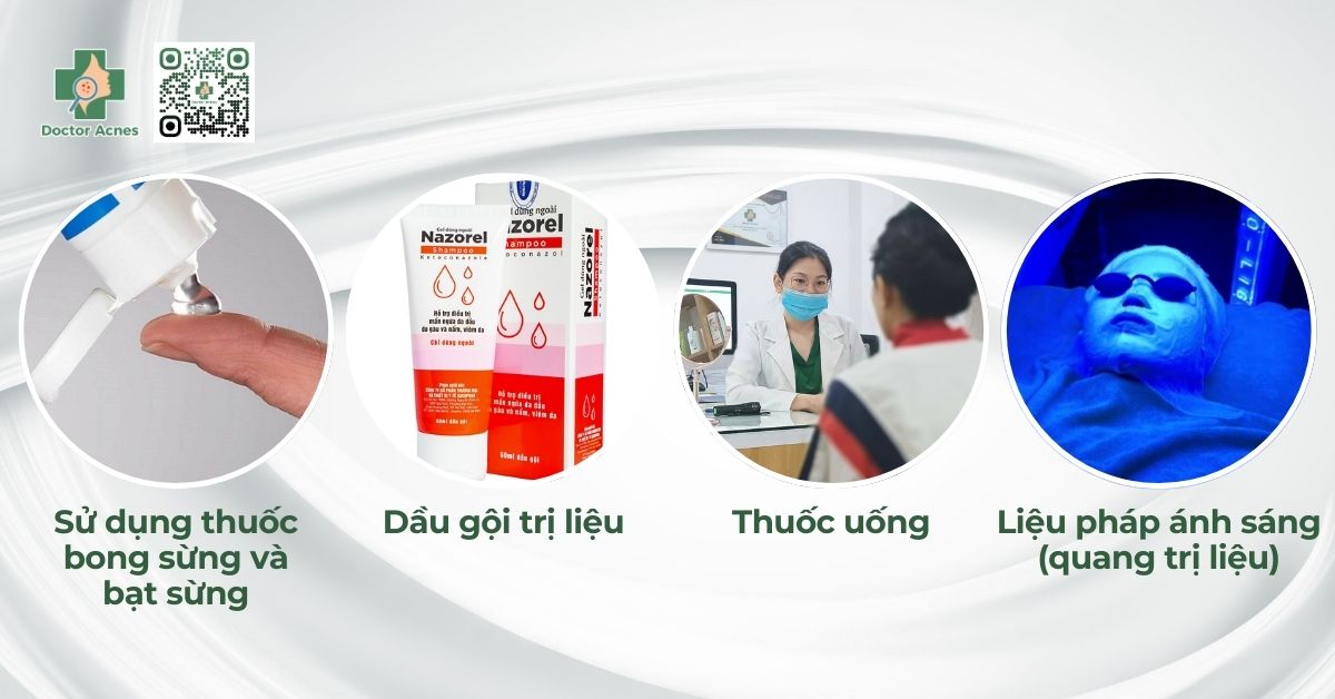 phương pháp điều trị viêm da tiết bã