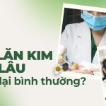 Sau lăn kim bao lâu da trở lại bình thường?