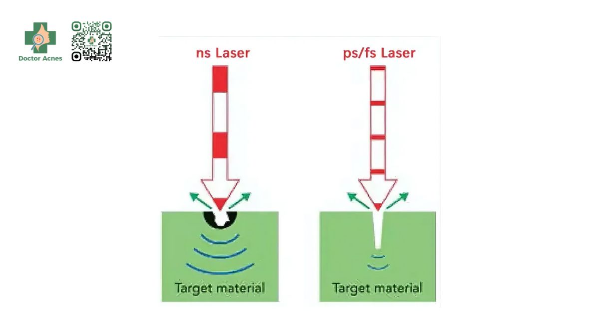 so sánh hiệu quả giữa laser pico và nano