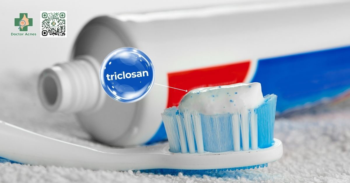 triclosan trong kem đánh răng có trị mụn