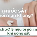 Uống thuốc sắt có bị nổi mụn không? Cách xử lý nếu bị nổi mụn khi uống sắt