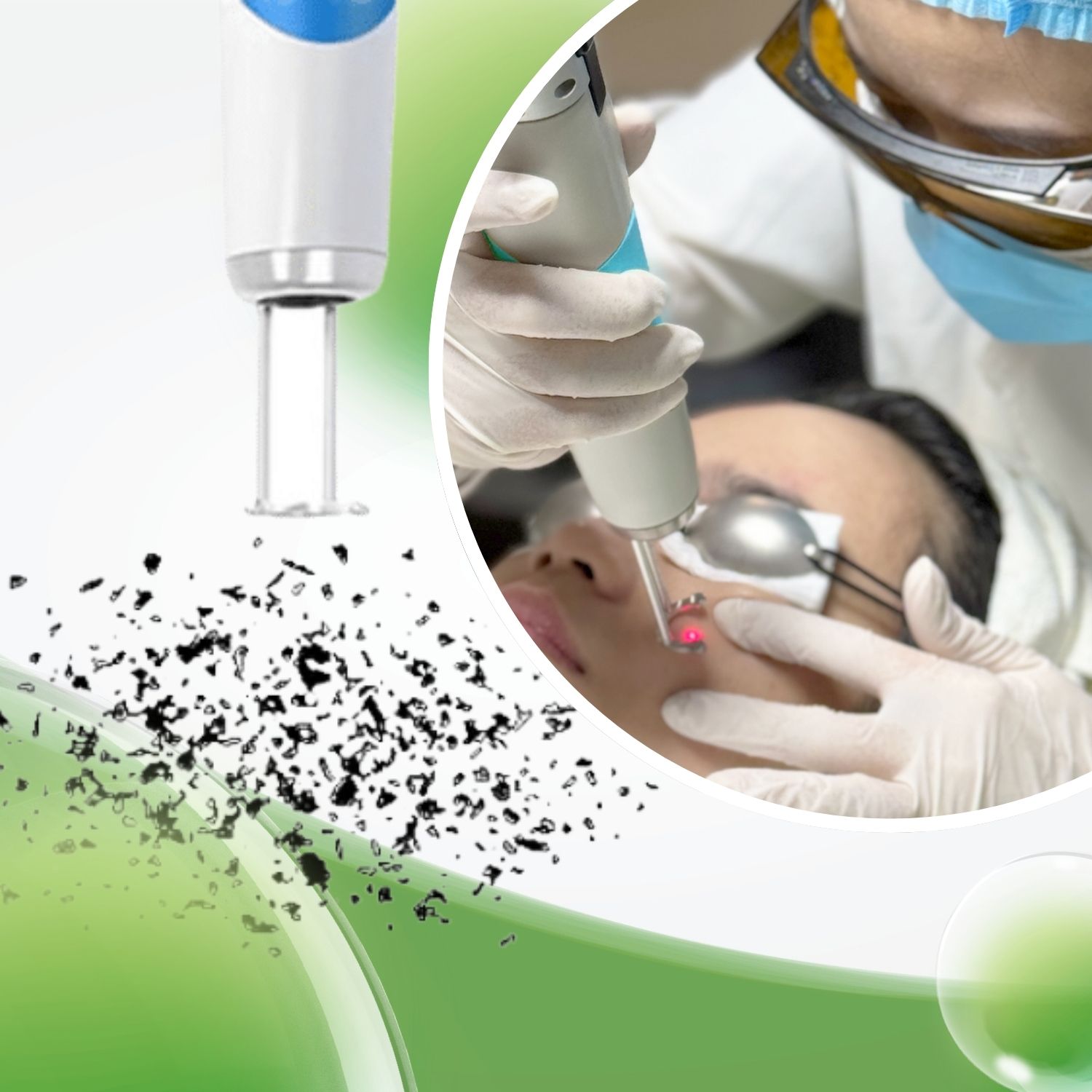 Cơ chế Laser pico Discovery