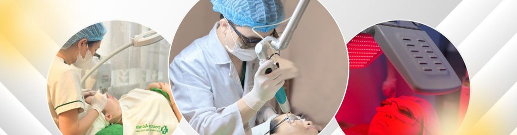 Quy trình Laser Discovery trị thâm nám Doctor Acnes