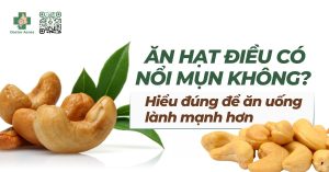 ăn hạt điều có nổi mụn không