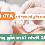 Chấm TCA trị sẹo rỗ giá bao nhiêu? Bảng giá mới nhất 2025