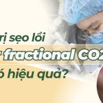 Điều trị sẹo lồi bằng laser fractional CO2 liệu có hiệu quả?