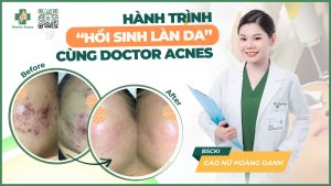 Hành trình hồi sinh làn da cùng Doctor Acnes
