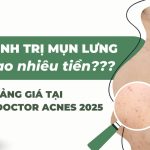 Liệu trình trị mụn lưng bao nhiêu tiền? Bảng giá tại Doctor Acnes 2025