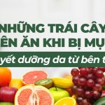 Những trái cây nên ăn khi bị mụn, bí quyết dưỡng da từ bên trong