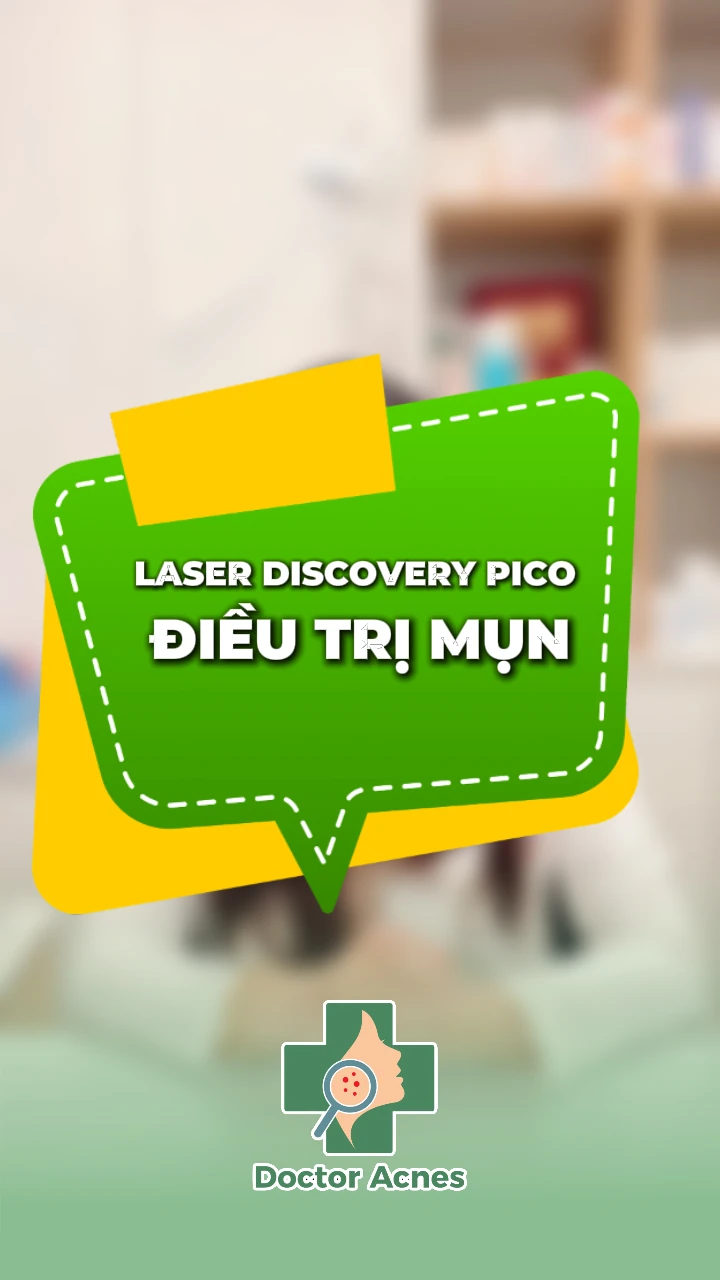 thumb laser discovery điều trị mụn doctor acnes