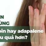 Trị mụn nên dùng tretinoin hay adapalene thì hiệu quả hơn?