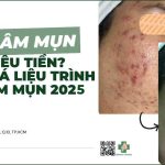 Trị thâm mụn bao nhiêu tiền? Bảng giá liệu trình trị thâm mụn 2025