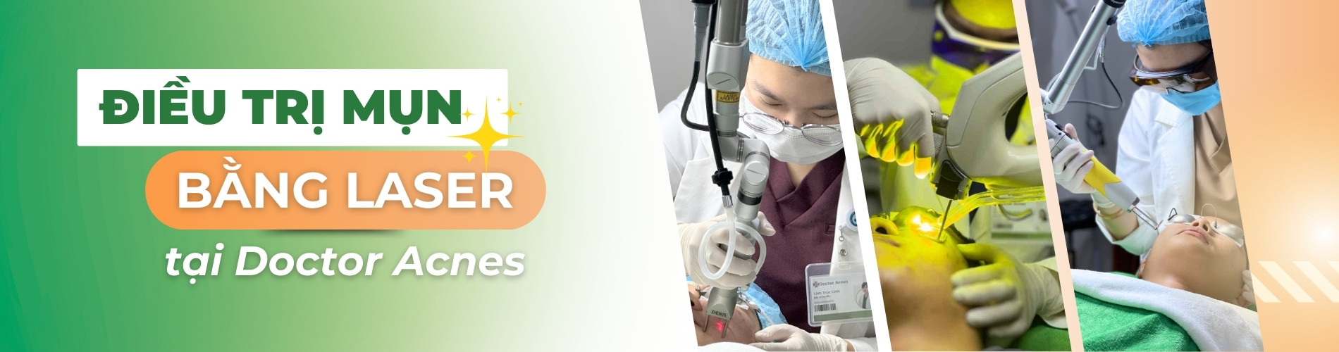 Banner LDP Điều trị mụn bằng Lasẻ Doctor Acnes
