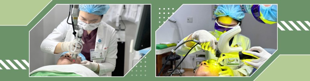 Banner hệ thống laser Deka và Quanta 585 trị mụn