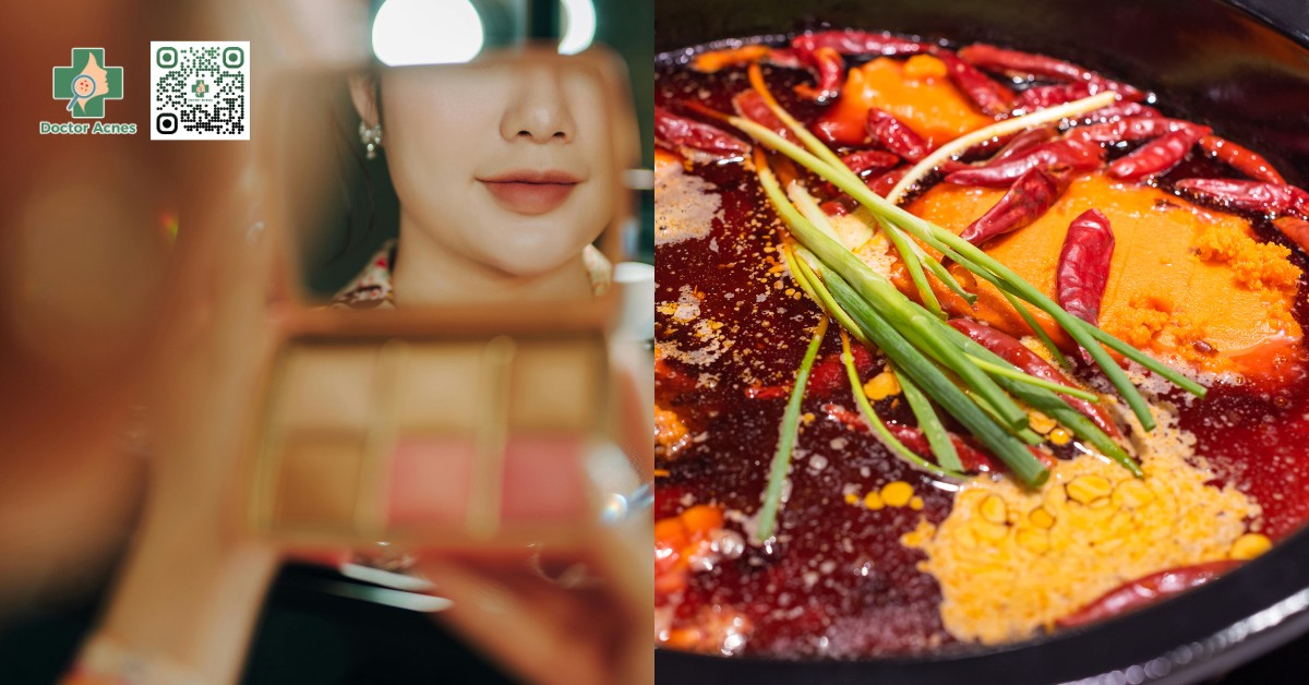 một số nguyên nhân gây mụn ẩn