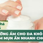 Khám phá top 5 kem dưỡng ẩm cho da khô bị mụn, giảm mụn ẩn nhanh chóng