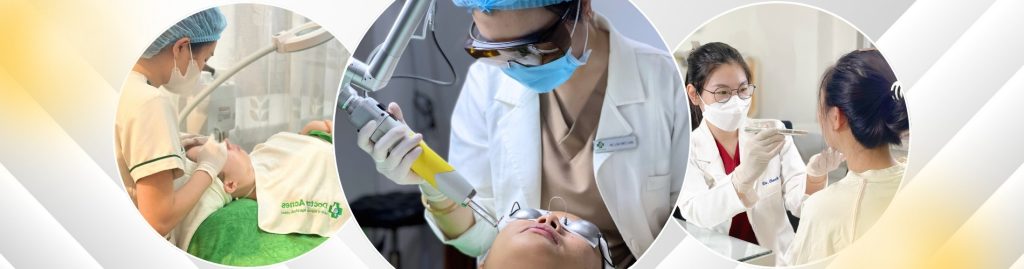 Quy trình laser điều trị mụn Doctor Acnes