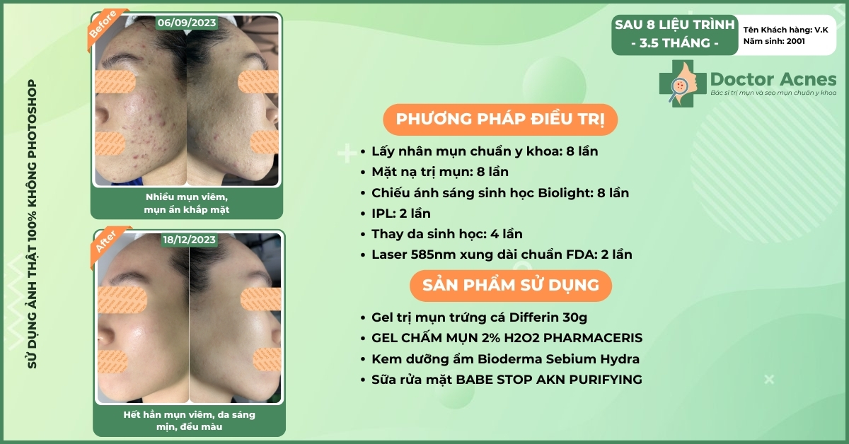 ca lâm sàng kiều vy