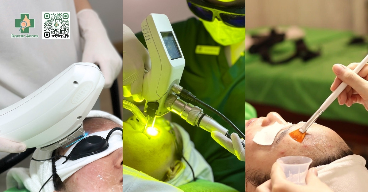 các phương pháp chuyên sâu điều trị thâm mụn
