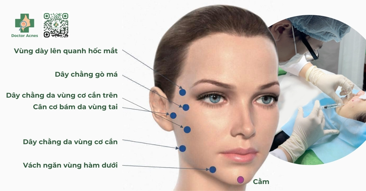 kỹ thuật tiêm jalupro