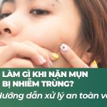 Làm gì khi nặn mụn bị nhiễm trùng? Hướng dẫn xử lý an toàn và hiệu quả