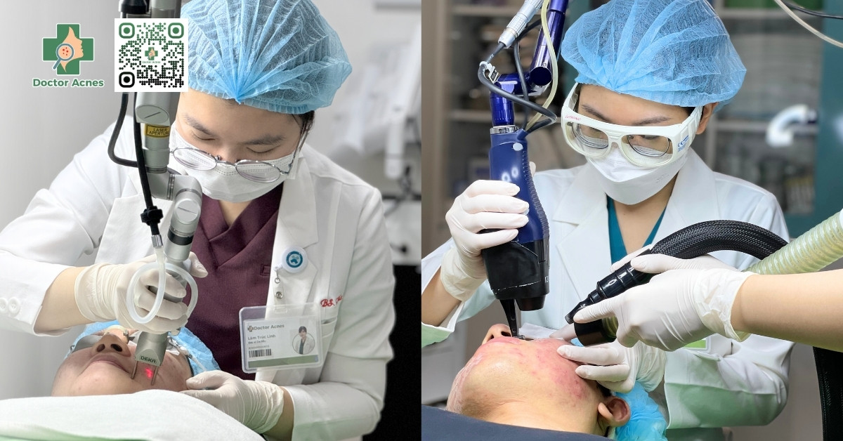 laser fractional co2