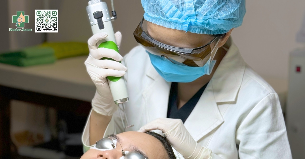 laser pico trị thâm