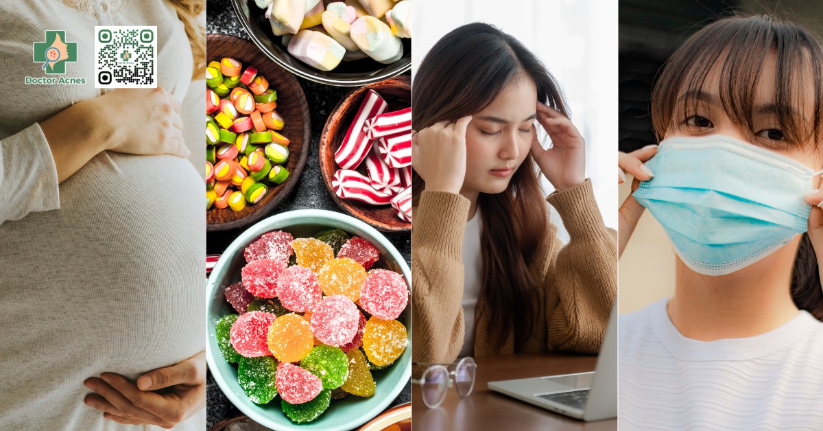 nguyên nhân mụn ẩn dưới cằm