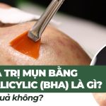 Peel da trị mụn bằng acid salicylic (BHA) là gì? Có hiệu quả không?