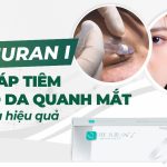 Rejuran I – Giải pháp tiêm tái tạo da quanh mắt an toàn và hiệu quả