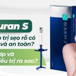 Rejuran S – Giải pháp trị sẹo rỗ có hiệu quả và an toàn? Ai phù hợp và chi phí điều trị ra sao?