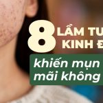8 lầm tưởng kinh điển khiến mụn mãi không hết