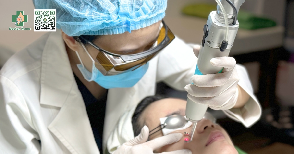 sử dụng laser để trị thâm