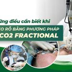 Điều trị sẹo rỗ bằng laser CO2 fractional có hiệu quả không? Ưu điểm và tác dụng phụ