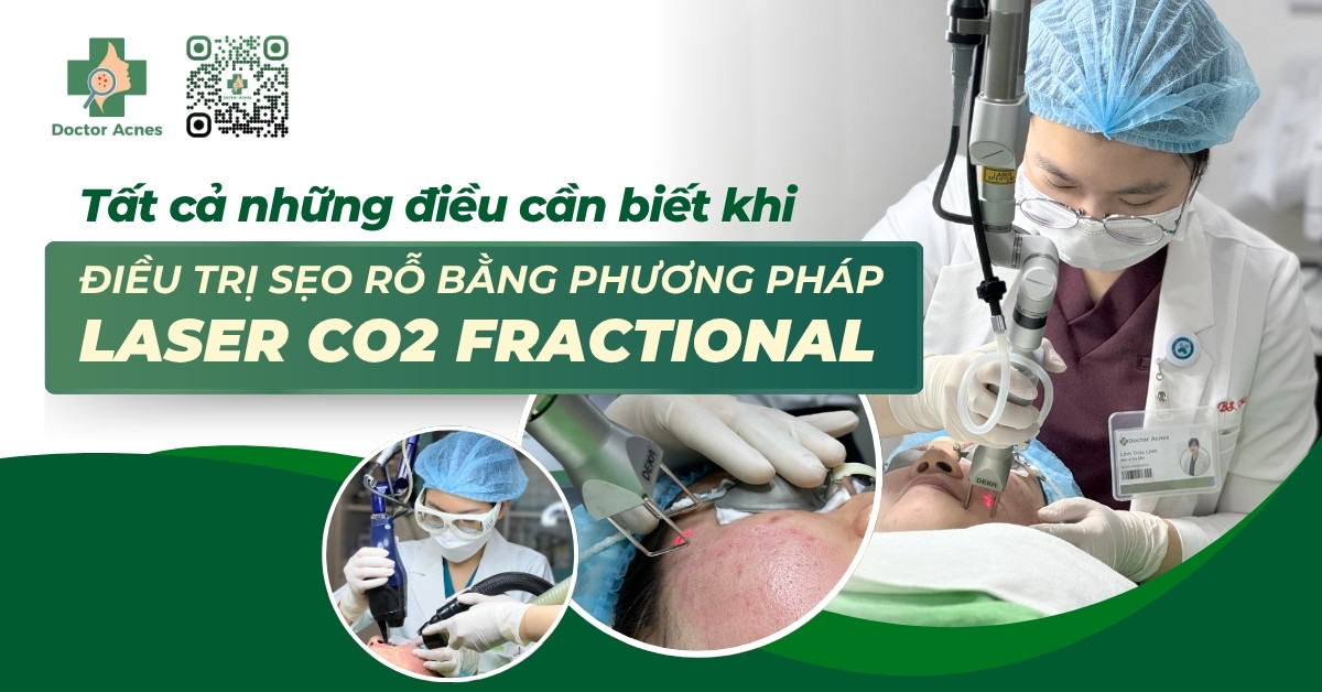tất cả những điều cần biết khi điều trị sẹo rỗ