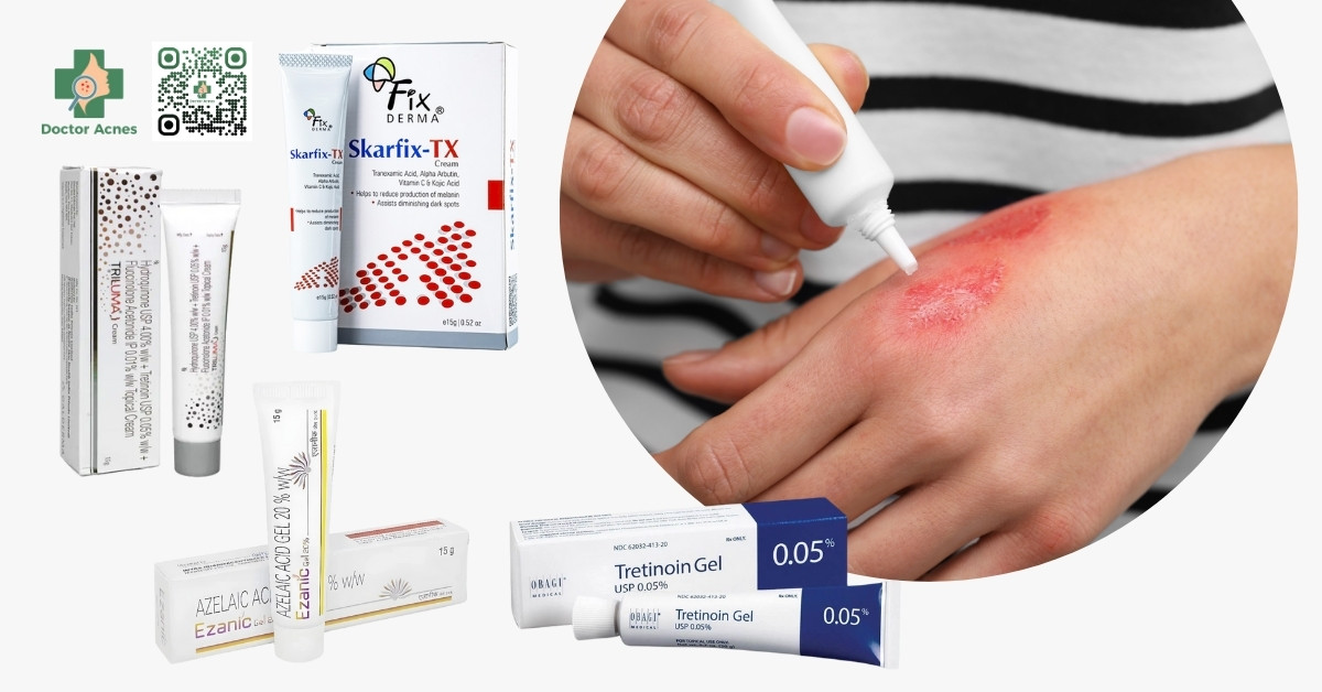 vết bỏng bị thâm đen có sao không