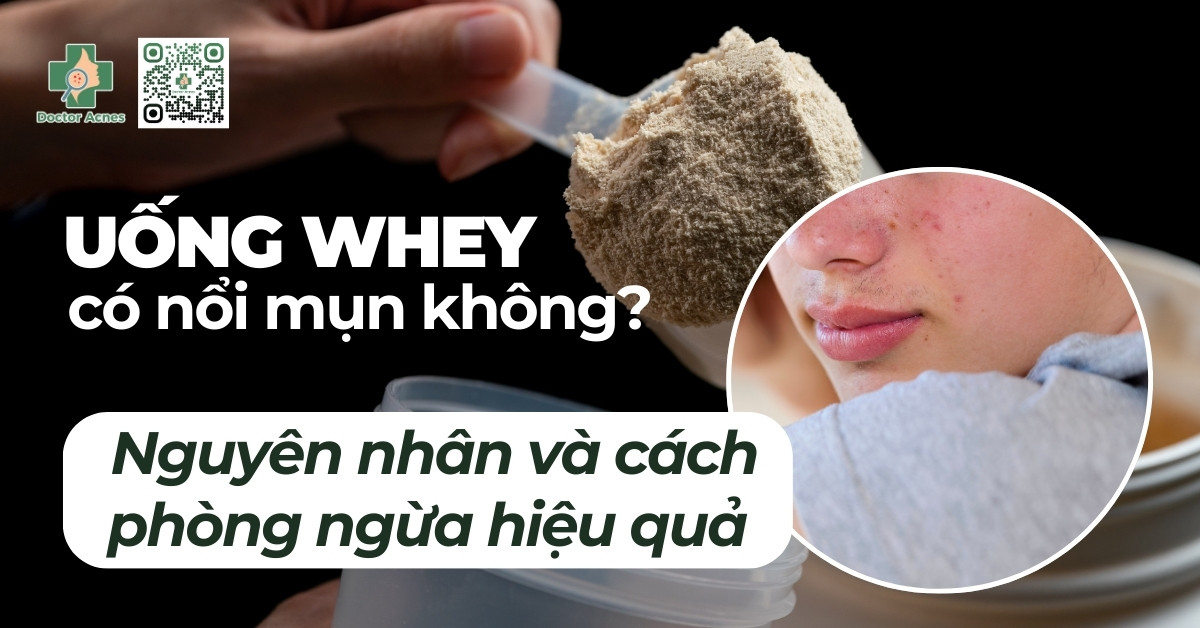 uống whey có nổi mụn không