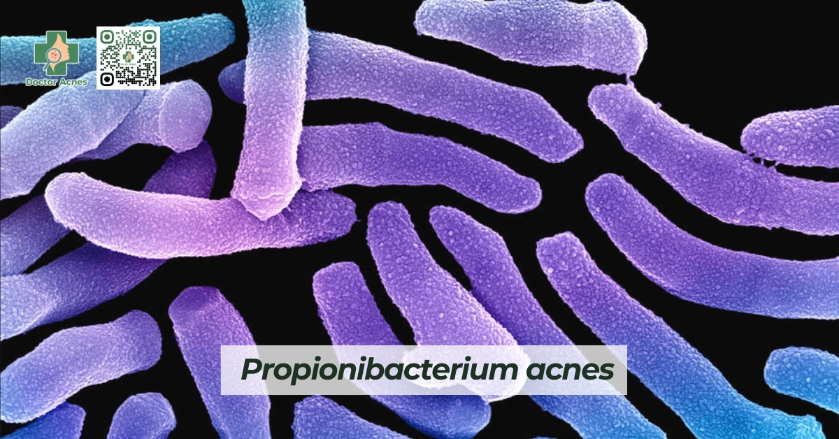 vi khuẩn propionibacterium acnes