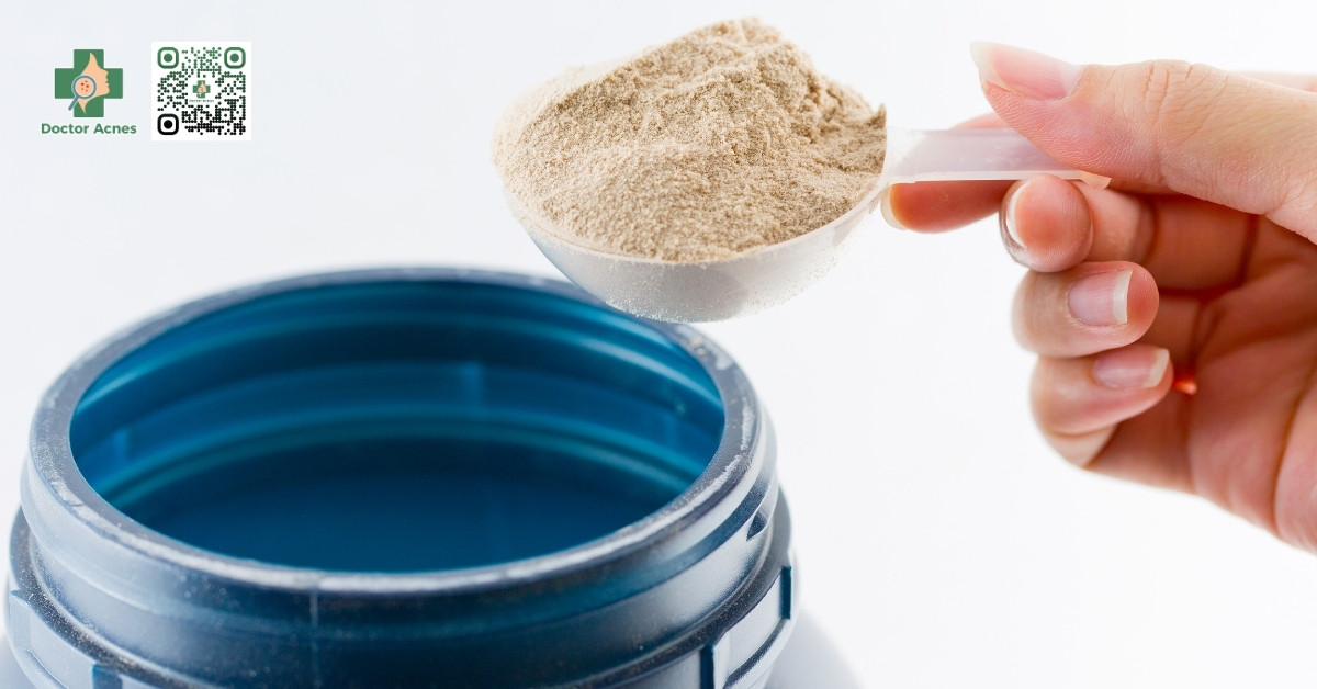 tại sao uống whey lại nổi mụn