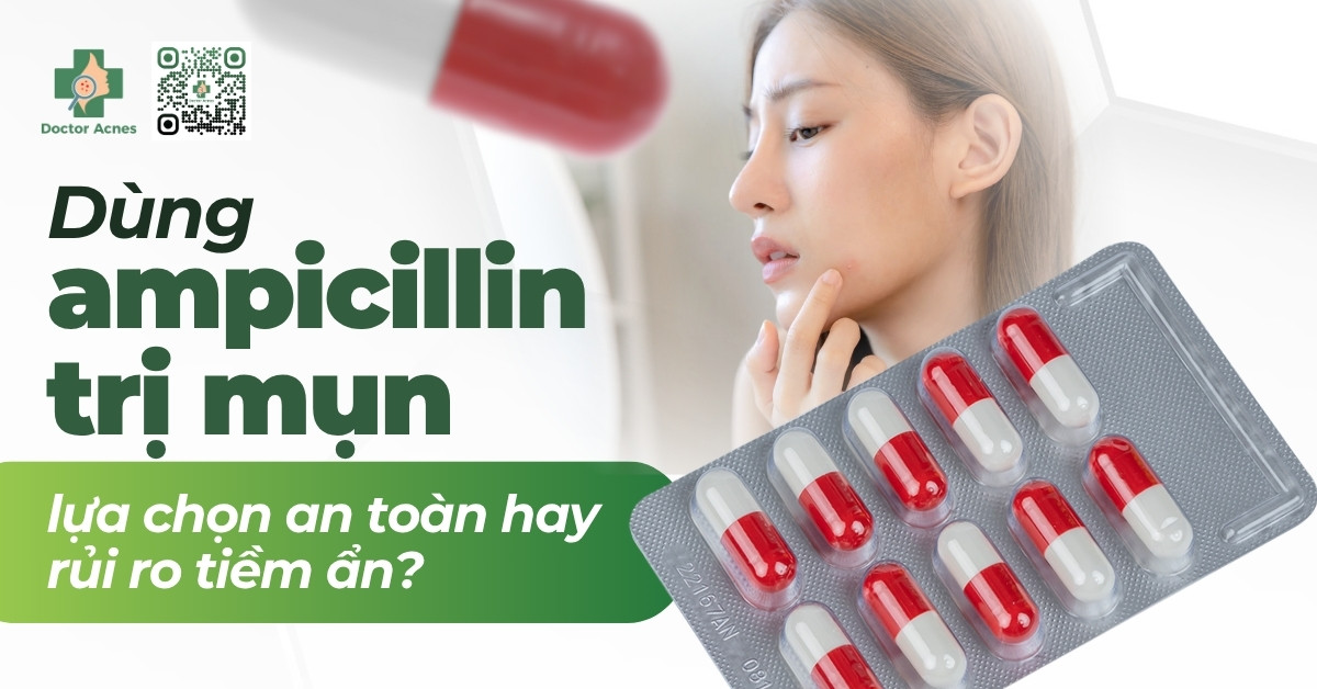 dùng ampicillin trị mụn