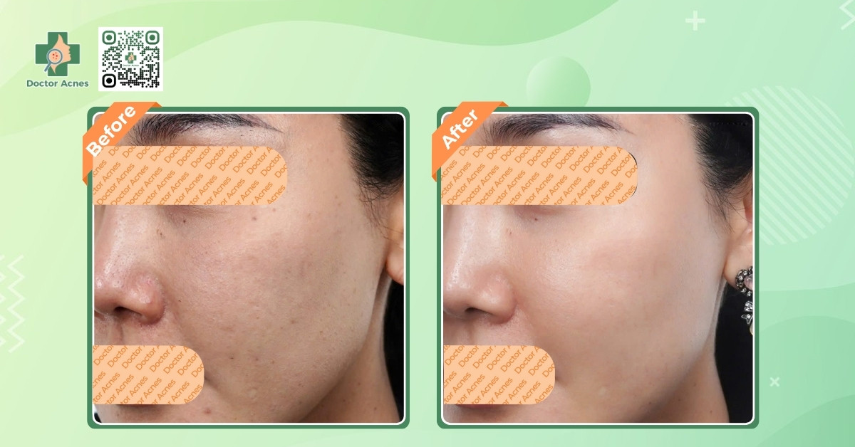 hiệu quả rõ rệt khi tiêm rejuran healer