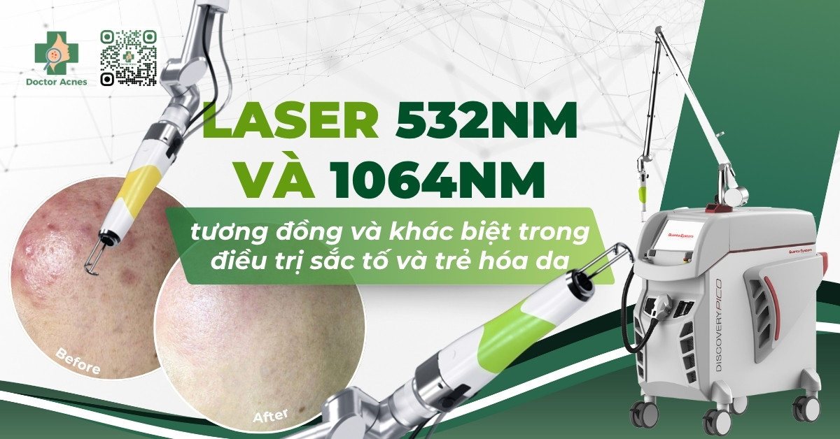laser 532nm và 1064nm