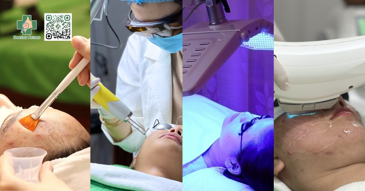 phương pháp