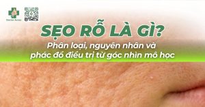 sẹo lõm nguyên nhân và phác đồ điều trị