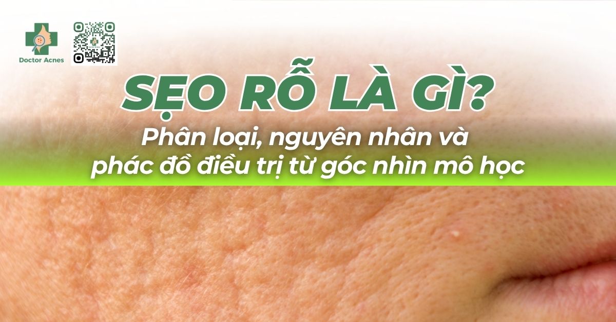 sẹo lõm nguyên nhân và phác đồ điều trị