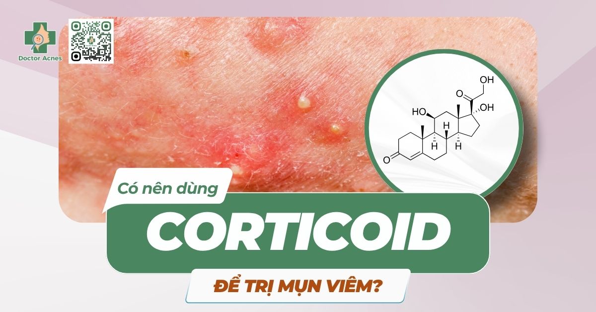 thumb doctor acnes- có nên dùng corticoid để trị mụn viêm