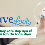 Juvelook – Giải pháp làm đầy sẹo rỗ và tái tạo da toàn diện tại Doctor Acnes