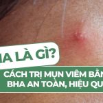 BHA là gì? Cách trị mụn viêm bằng BHA an toàn, hiệu quả